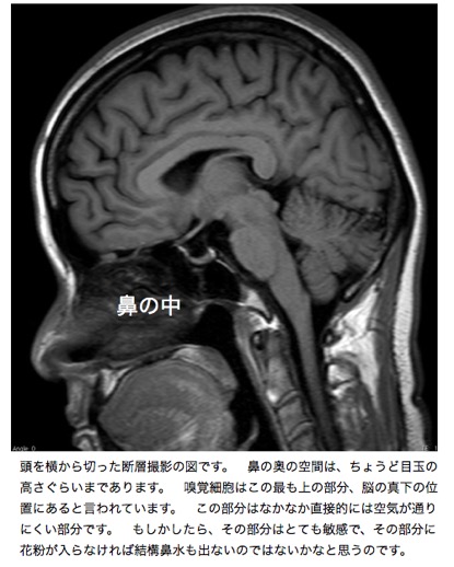 花粉症.002