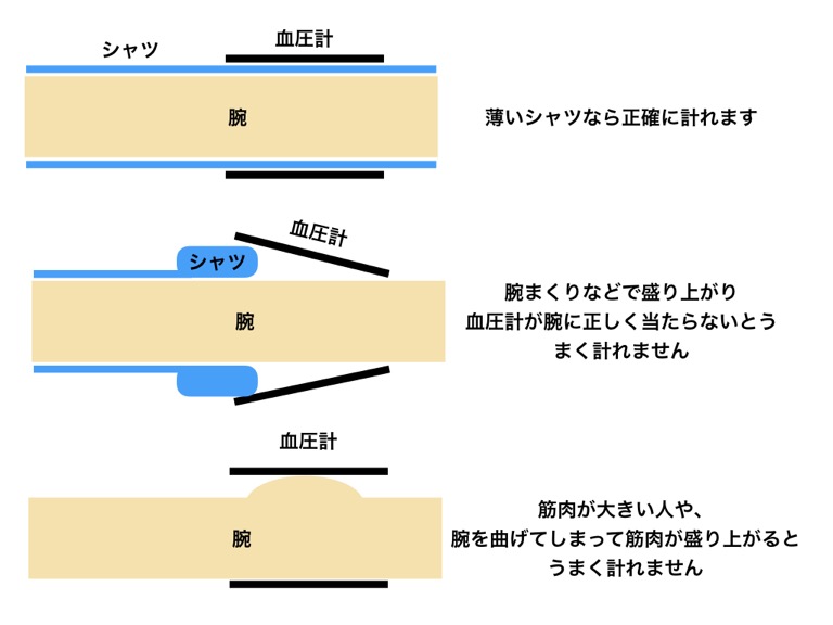 血圧 緊張 しない 方法